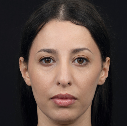 Before/After Image